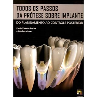Livro - Todos os Passos da Prótese sobre Implante - Do Planejamento ao Controle Posterior - Rocha