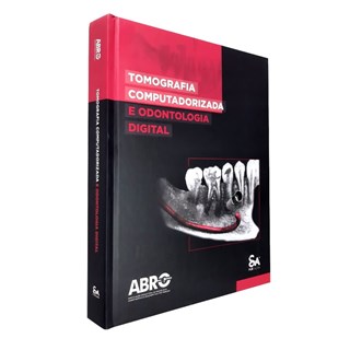 Livro - Tomografia Computadorizada e Odontologia Digital - Abro