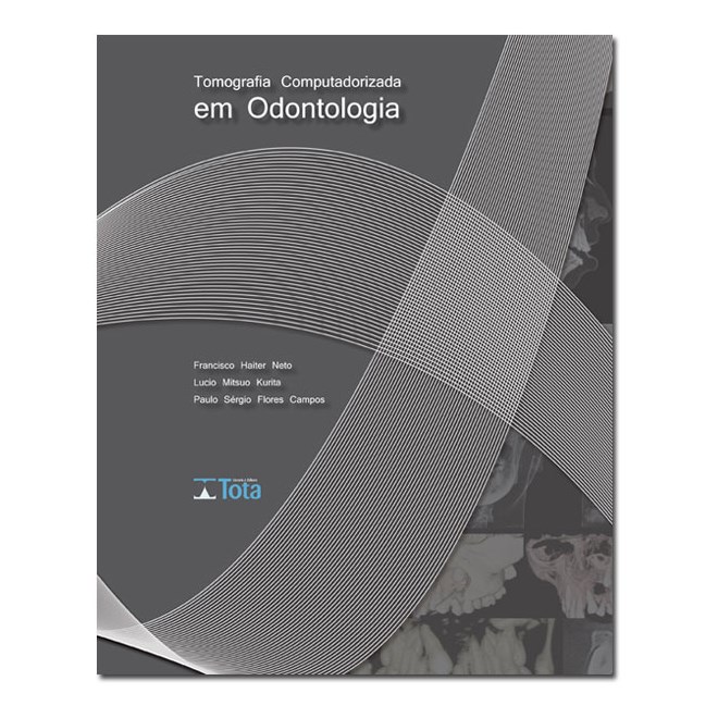 Livro Tomografia Computadorizada em Odontologia - Neto - Tota