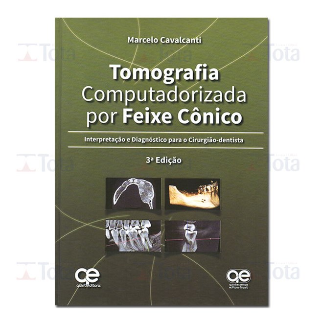 Livro - Tomografia Computadorizada por Feixe Conico - Cavalcanti