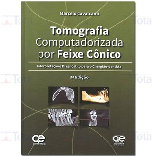 Livro - Tomografia Computadorizada por Feixe Cônico - Interpretação e Diagnóstico para o Cirurgião-Dentista - Cavalcanti - Santos