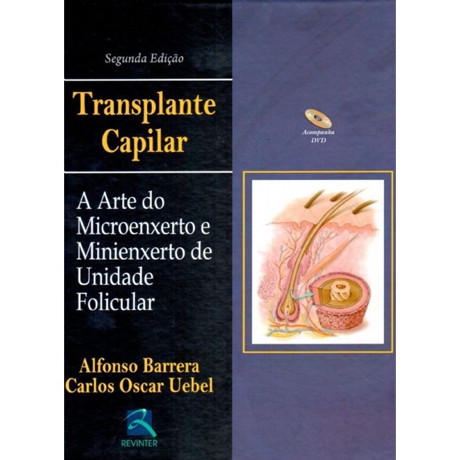 Livro - Transplante Capilar - a Arte do Microenxerto - Barrera/uebel