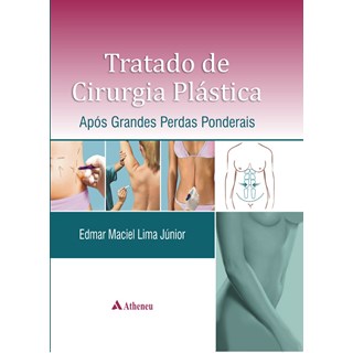 Livro - Tratado de Cirurgia Plástica - Após Grandes Perdas Ponderais - Lima Júnior