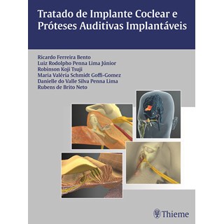 Livro Tratado de Implante Coclear e Próteses Auditivas Implantáveis - Bento - Revinter