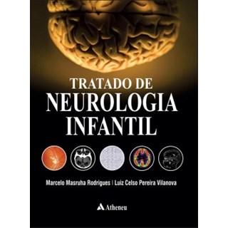 Livro - Tratado de Neurologia Infantil - Rodrigues/vilanova