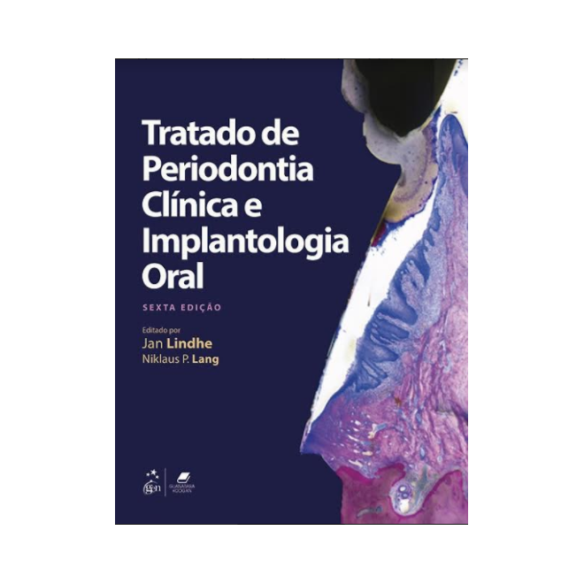 Tratado De Periodontia Clínica E Implantologia Oral