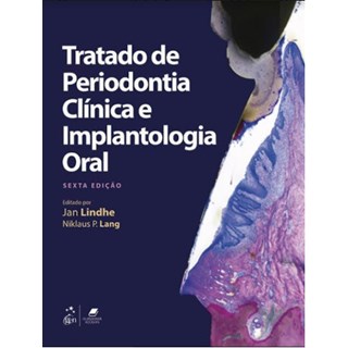 Livro Tratado de Periodontia Clínica e Implantologia Oral - Lindhe