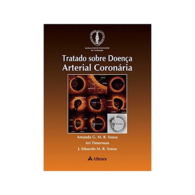 Livro - Tratado sobre Doenca Arterial Coronaria - Sousa/timerman