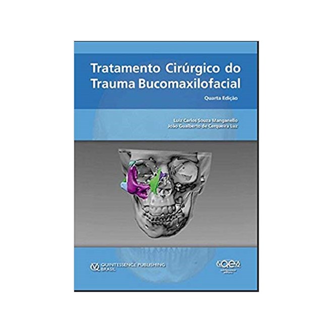 Livro - Tratamento Cirúrgico do Trauma Bucomaxilofacial - Souza - Santos