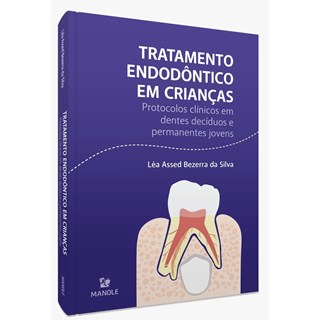 Livro - Tratamento Endodôntico em Crianças: Protocolos Clínicos em Dentes Decíduos - Silva - Manole