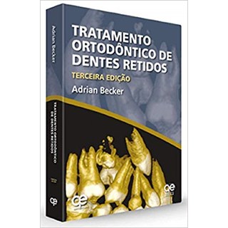 Livro - Tratamento Ortodontico de Dentes Retidos - Becker