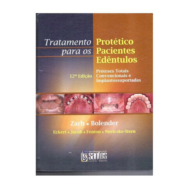 Livro Tratamento Protético para os Pacientes Edentulos - Zarb - Santos