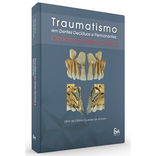 Livro - Traumatismo em Dentes Deciduos e Permanentes: Ciencia Na Pratica Clinica - Amorim