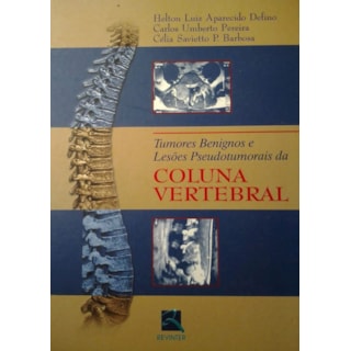 Livro - Tumores Benignos e Lesões Pseudotumorais da Coluna Vertebral - Defino *** Livro - Tumores Benignos e Lesões Pseudotumorais da Coluna Vertebral - Defino ***