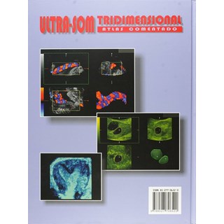 Livro - Ultra-som Tridimensional - Atlas Comentado - Montenegro