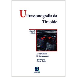 Livro - Ultra-sonografia da Tireoide - Tramalloni/monpeysse