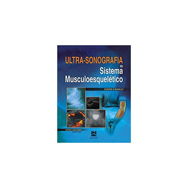 Livro - Ultra-sonografia do Sistema Musculoesqueletico - Mcnally