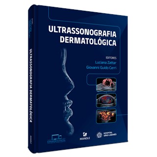 Livro Ultrassonografia Dermatológica - Zattar - Manole