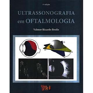 Livro - Ultrassonografia em Oftalmologia 1 Ed 2021 - Ricardo