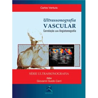 Livro - Ultrassonografia Vascular - Ventura/cerri