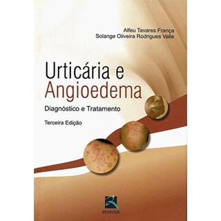 Livro - Urticaria e Angioedema - Diagnostico e Tratamento - Franca/valle