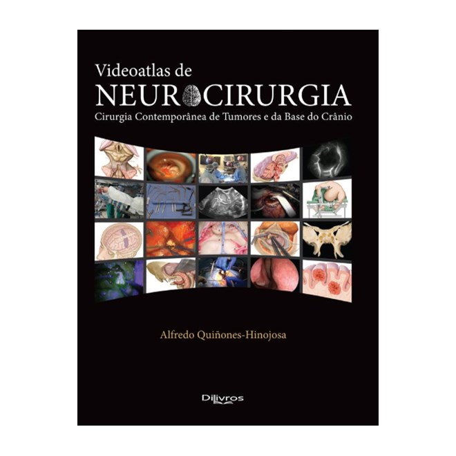 Livro - Videoatlas de Neurocirurgia: Cirurgia Contemporanea de Tumores e da Base do - Quinones-hinojosa
