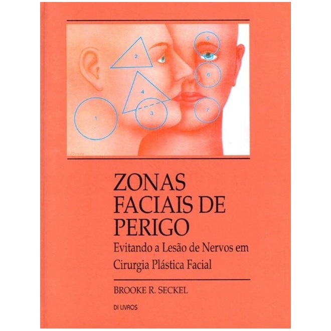 Livro Zonas Faciais de Perigo: Evitando a Lesao de Nervos em Cirurgia Plastica Fa - Seckel